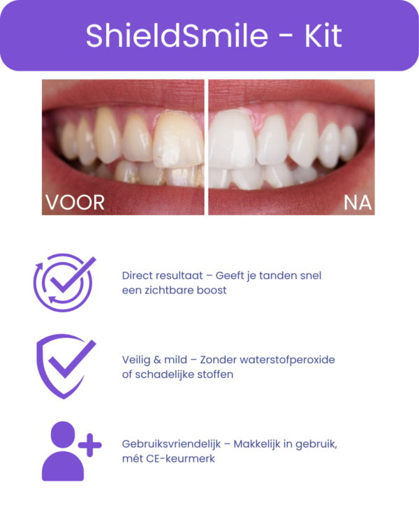 Alternatief Smile  - Tandpasta - Afbeelding 3
