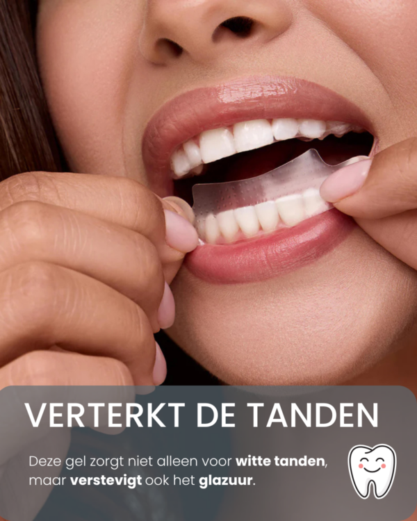 Alternatief Smile  - Bleek Strips - Afbeelding 2
